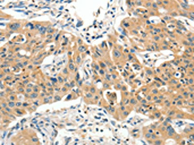 SLC11A2 Antibody
