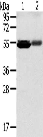SLC17A1 Antibody