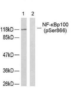 Phospho-NFKB2 (Ser866) Antibody