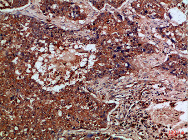 FLT4 Antibody