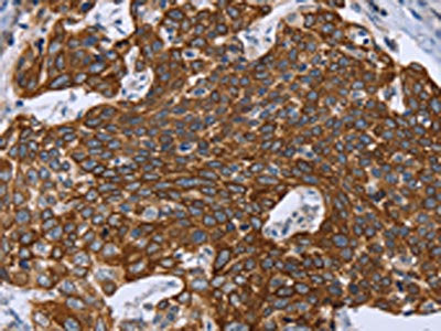 GRPR Antibody