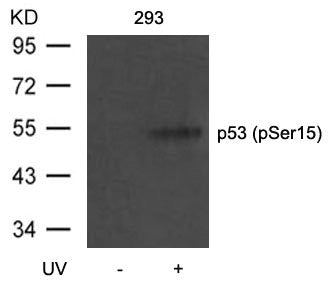 Phospho-TP53 (Ser15) Antibody