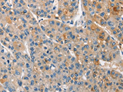 APOA5 Antibody