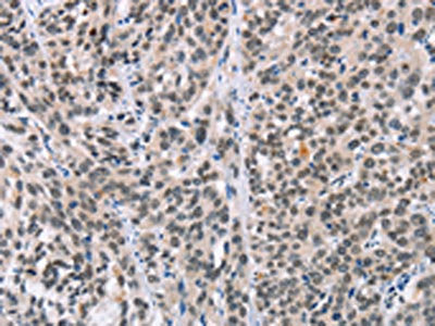 ADNP Antibody