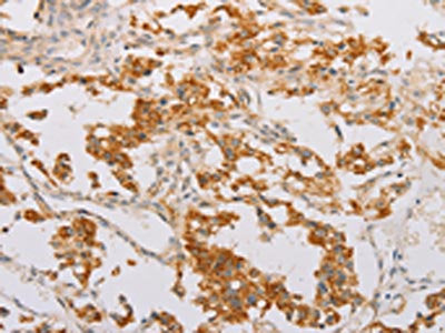 STK40 Antibody
