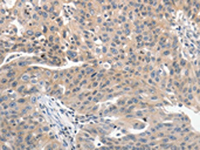 PRKD1 Antibody