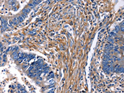 CXCR5 Antibody