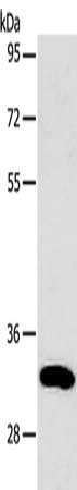 TIMP3 Antibody