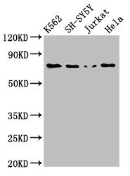 PRKCB Antibody