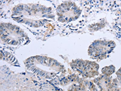 DOK5 Antibody