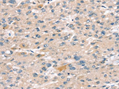 SULT2B1 Antibody