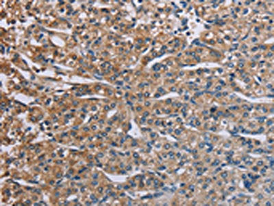PLXND1 Antibody