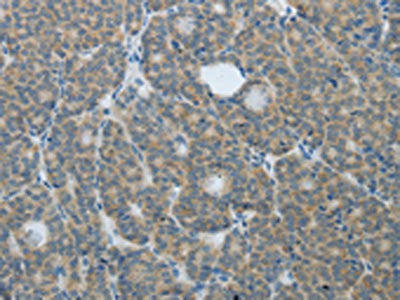 TP63 Antibody