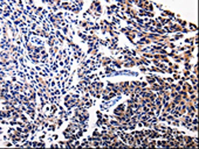 BIRC5 Antibody