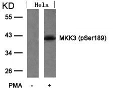 Phospho-MAP2K3 (Ser189) Antibody