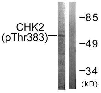 Phospho-CHEK2 (Thr383) Antibody