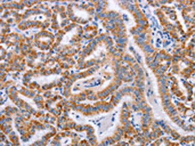 BST1 Antibody