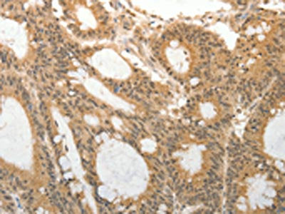 ADAR Antibody