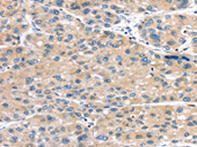 MASP2 Antibody