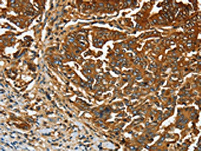 CEACAM5 Antibody