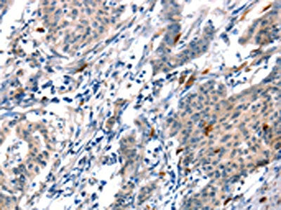 ADM Antibody