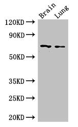 FOXO1 Antibody