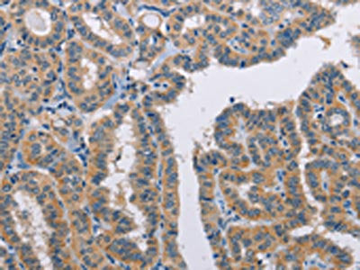 TLR8 Antibody