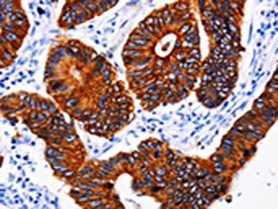 KRT6A Antibody