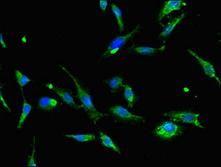 AQP2 Antibody