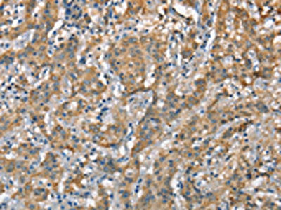 CSMD1 Antibody