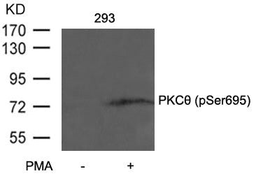 Phospho-PRKCQ (Ser695) Antibody