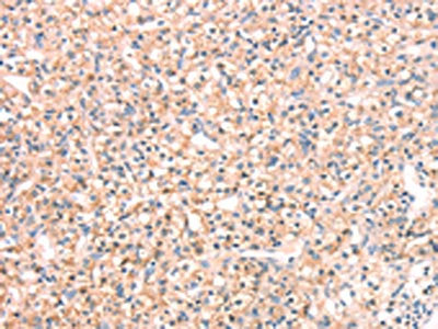 SNAP23 Antibody
