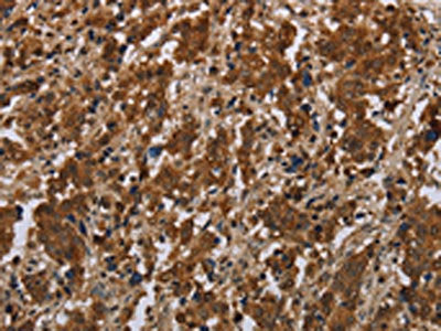 FGF20 Antibody