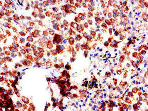 AQP6 Antibody