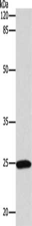RUNX1 Antibody