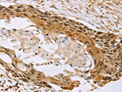 MED12 Antibody