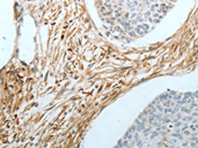 CRMP1 Antibody