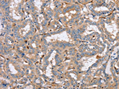 PPM1F Antibody