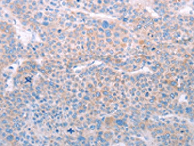 SPATA6 Antibody