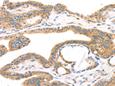 TPH2 Antibody