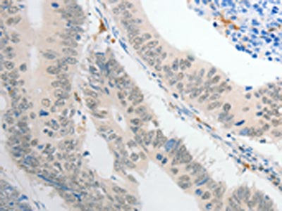 POU2F1 Antibody