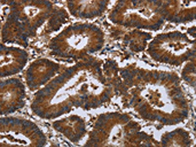CERS5 Antibody