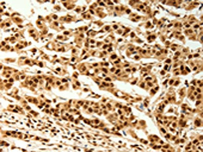 TIGAR Antibody
