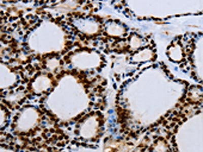 EGFR Antibody