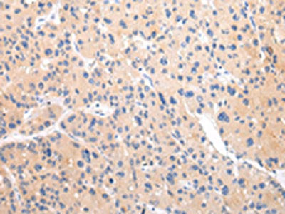 ZNF106 Antibody