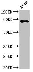 IKBKB Antibody