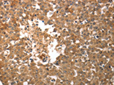 SLC22A6 Antibody