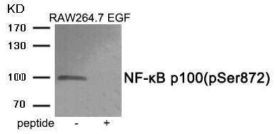 Phospho-NFKB2 (Ser872) Antibody