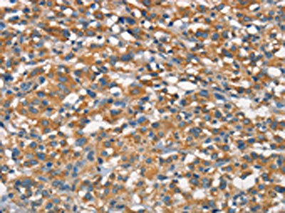 APOA1BP Antibody