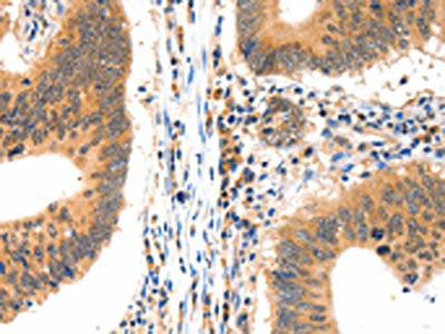 LRPPRC Antibody